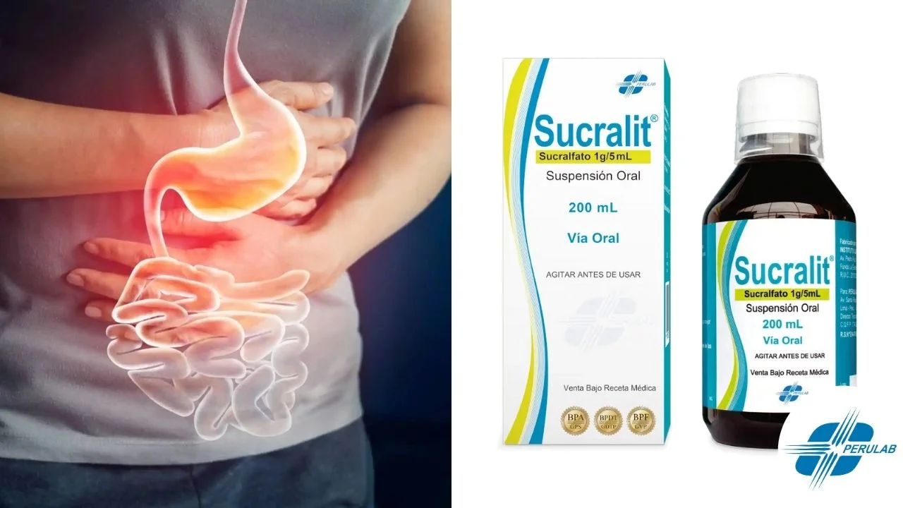 Para qué sirve el sucralfato en Perú y qué es